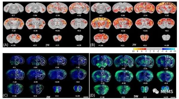 科学家在星形胶质细胞活体成像研究中获进展