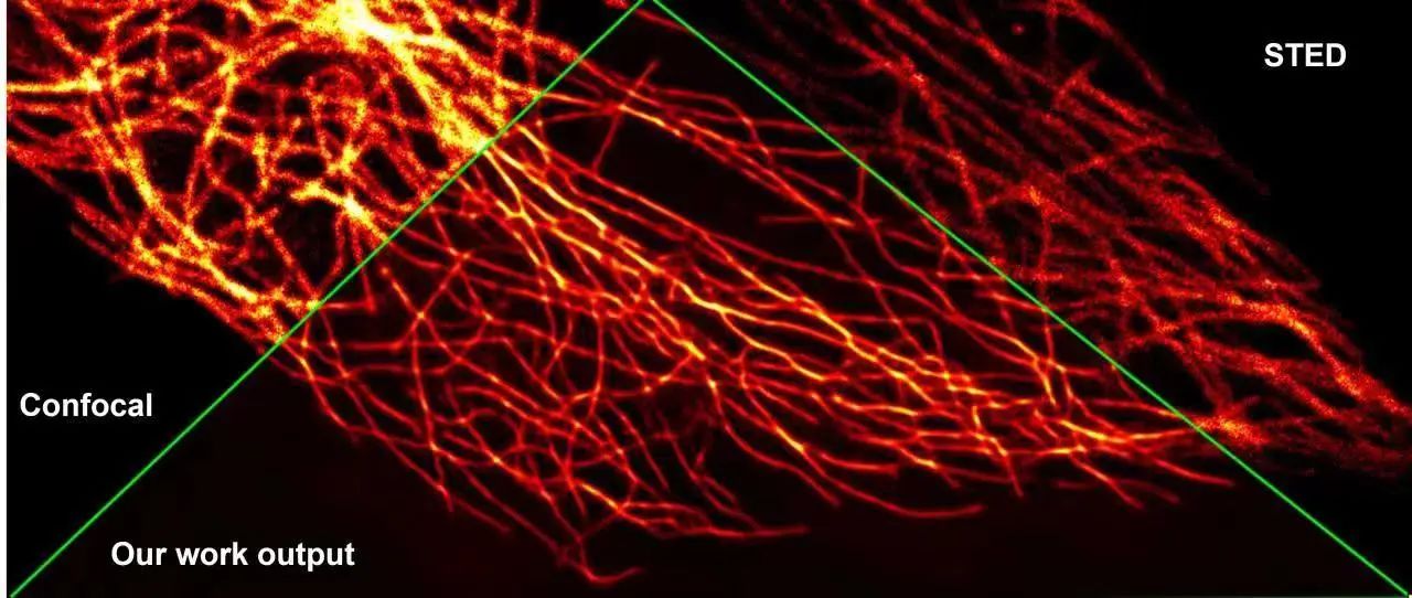 PhotoniX | 利用深度学习提高共聚焦显微的空间分辨率实现超分辨成像