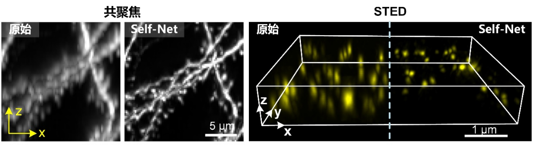 Light | 自学习实现三维同分辨率显微光学成像