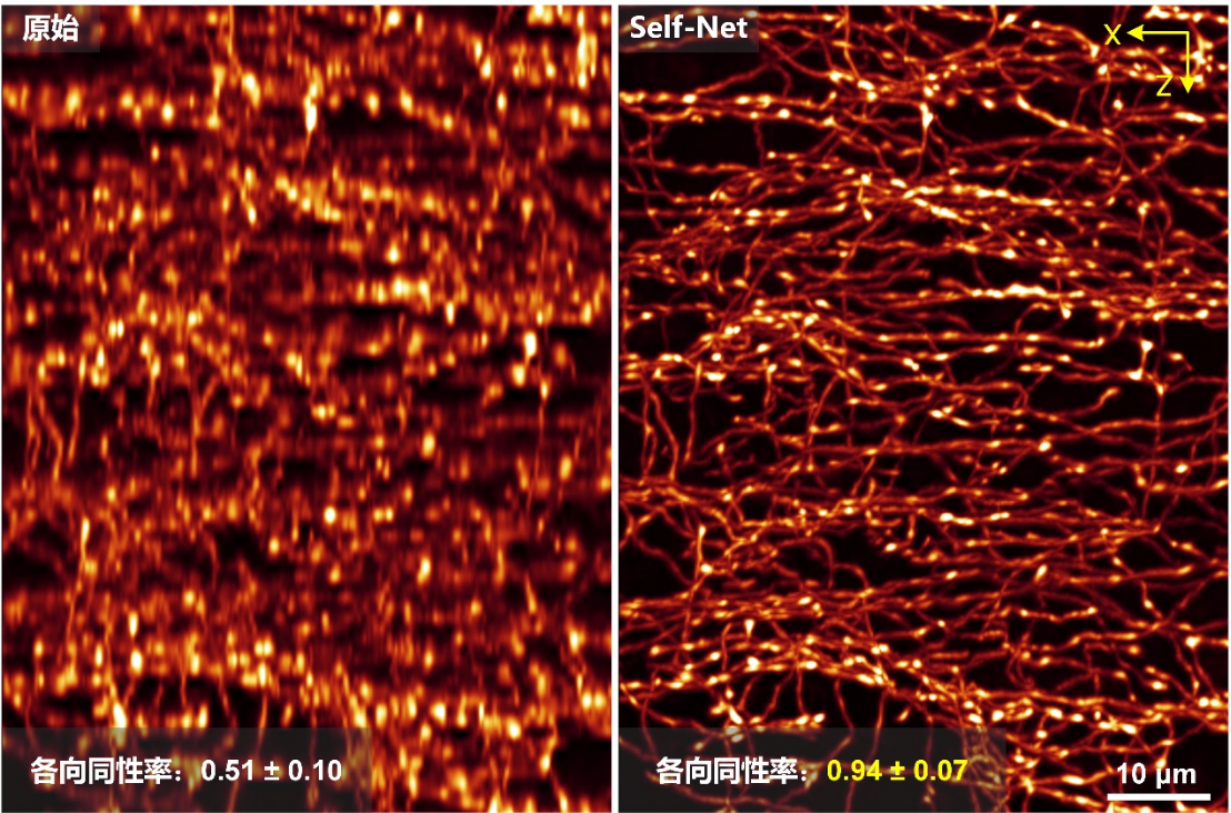 Light | 自学习实现三维同分辨率显微光学成像