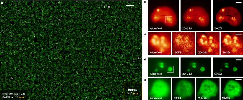 前沿：《Nature Photonics》突破，高通量超分辨显微成像照进现实