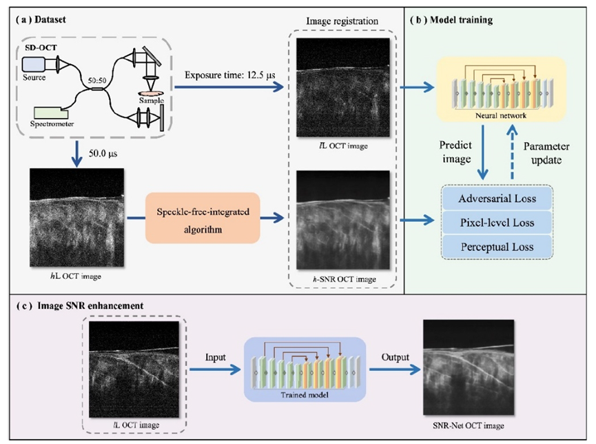 [文献速递Vol.215]-SNR-Net OCT：通过深度学习对低光光学相干断层扫描图像进行增亮和去噪