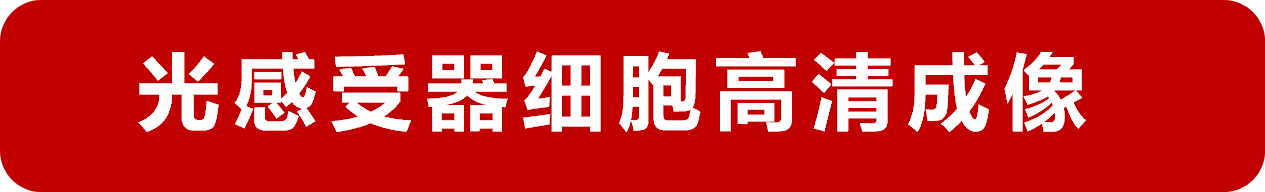 全球瞩目！首台商用自适应光学眼底影像系统震撼上市，引领眼科诊疗技术重大革新！