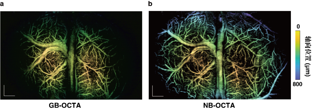 前沿 | 具有长焦深和高分辨率的光学相干层析血管造影术