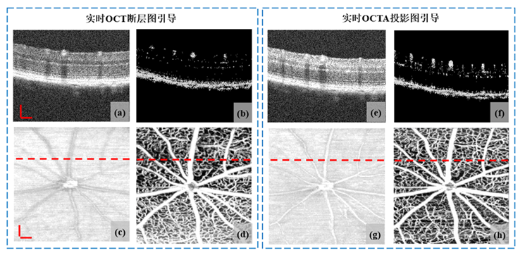 高速扫描OCT血流造影术，“看穿”眼底的秘密 |“医工融合转化”专题封面